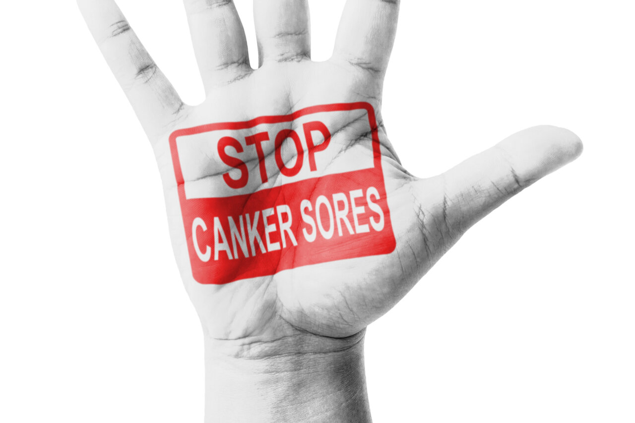 Canker sores are painful. Pain relievers can help alleviate discomfort.